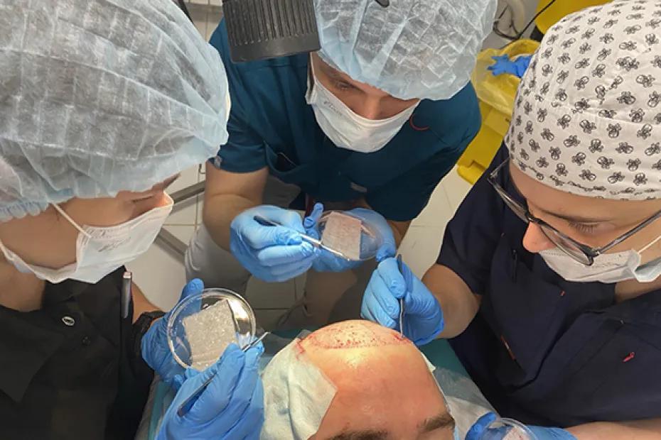 В Клиниках Самарского медуниверситета начали выполнять операции по пересадке волос