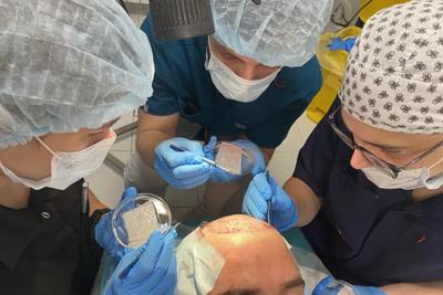 В Клиниках Самарского медуниверситета начали выполнять операции по пересадке волос