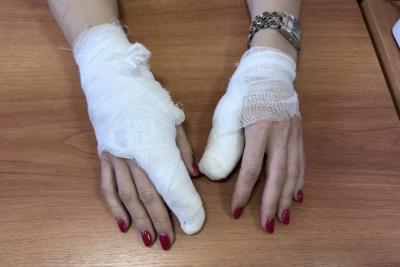Руками пришлось пожертвовать: в частном секторе Сызрани женщина оказалась между двух огней