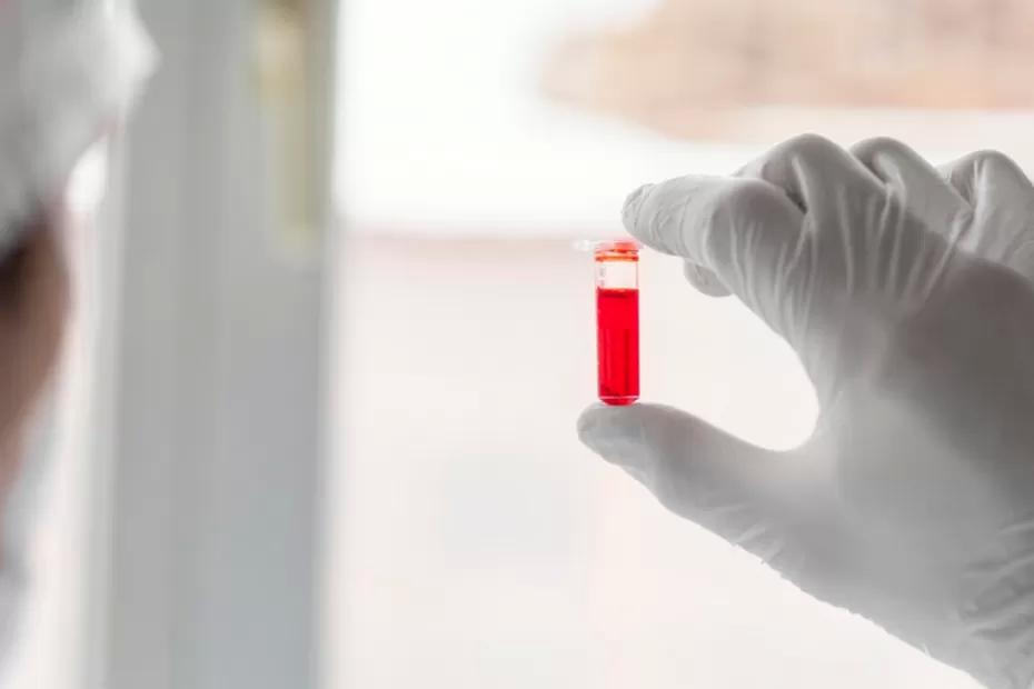Людям с этой группой крови суждено умереть до 60 лет: ученые сделали неутешительное заявление